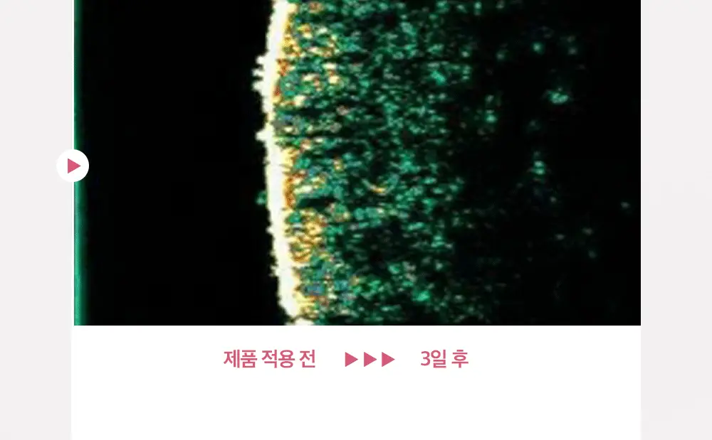 [7월올영픽/손상장벽리페어] 피지오겔 레드수딩 AI 리페어 크림 100m 기획(+30ml+마스크 2매) 상세페이지 19